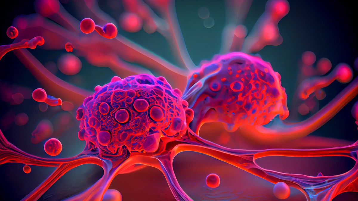 Ključne razlike između sarkoma i karcinoma