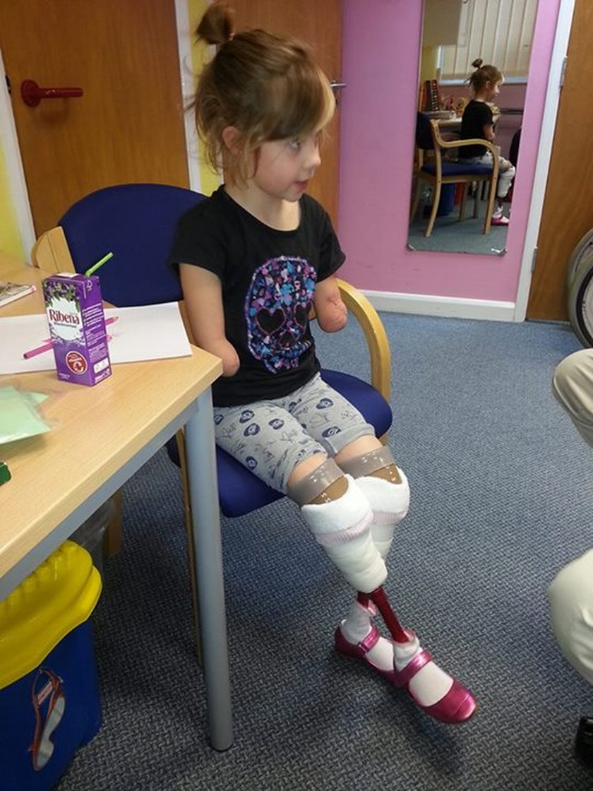 Straciła ręce i nogi przez chorobę. Zbiera na protezy