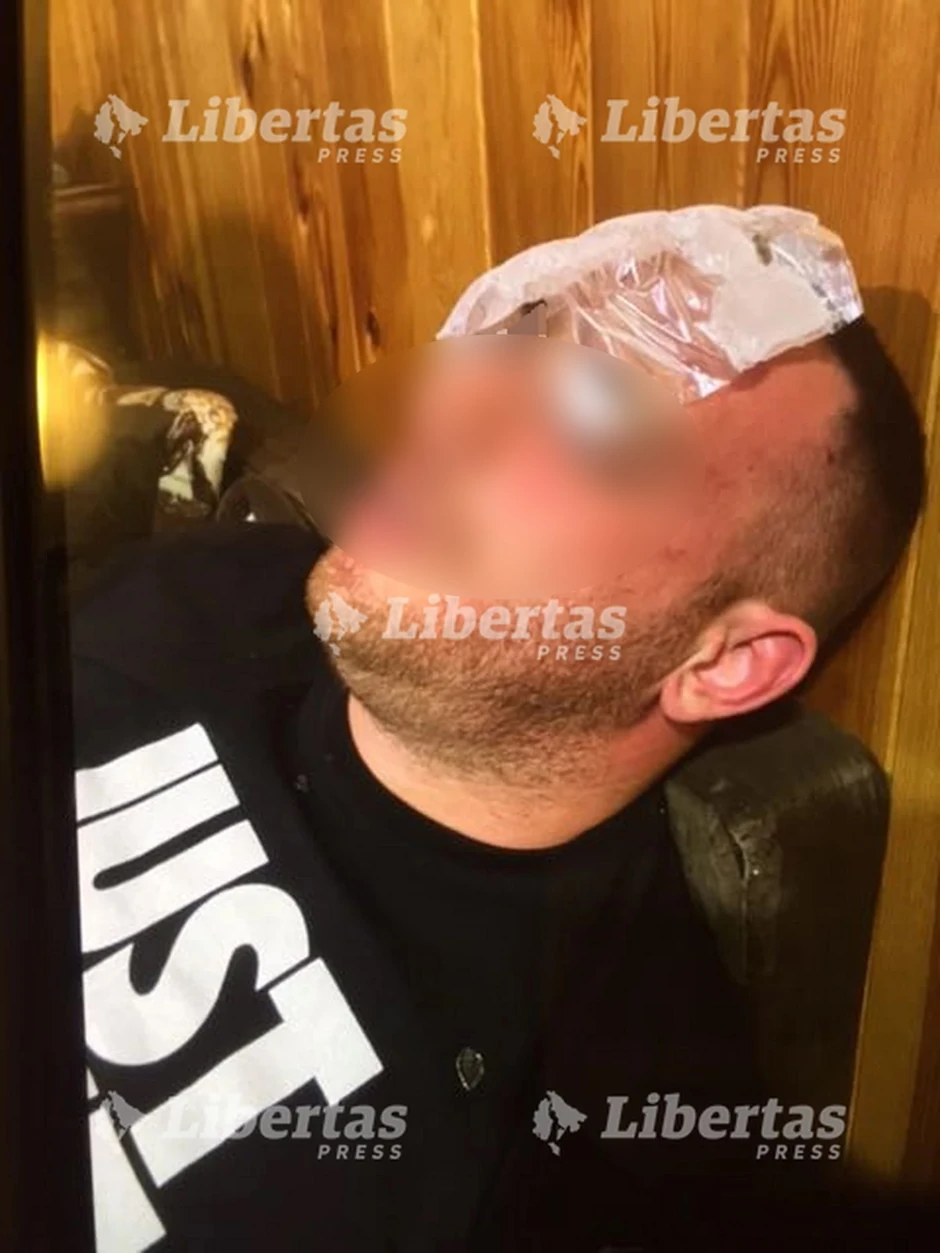 Dokazi torture crnogorskih policajaca