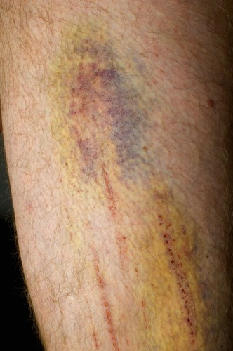 Co zniesmacza mężczyzn oglądających kobiety w bikini?