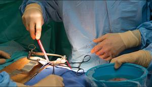 Kidney transplant [Dr. Vikas Agarwal]