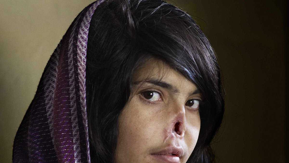 Zdjęciem roku w konkursie World Press Photo została fotografia przedstawiająca Bibi Aisha, 18-letnią afgańską dziewczynę, której mąż obciął nos i uszy. Autorem zdjęcia jest Jogi Bieber z RPA.