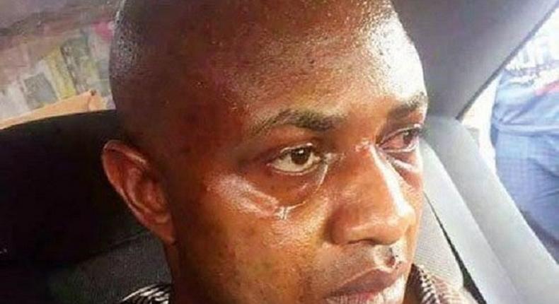 Evans has become a cry baby after his arrest