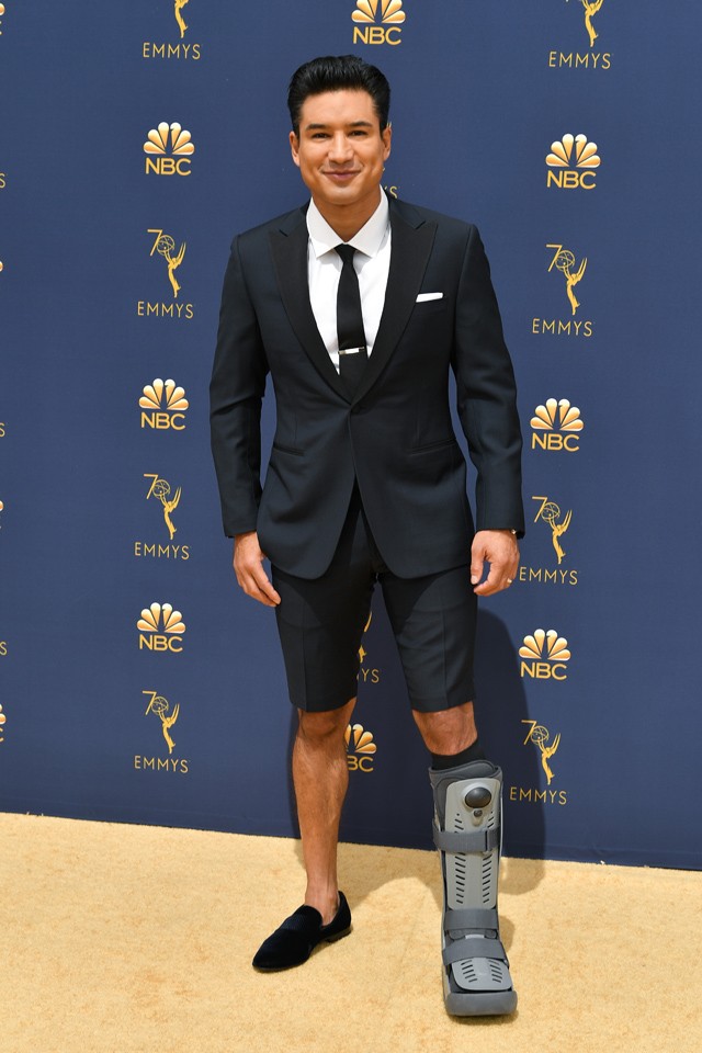 Mario Lopez gipsz