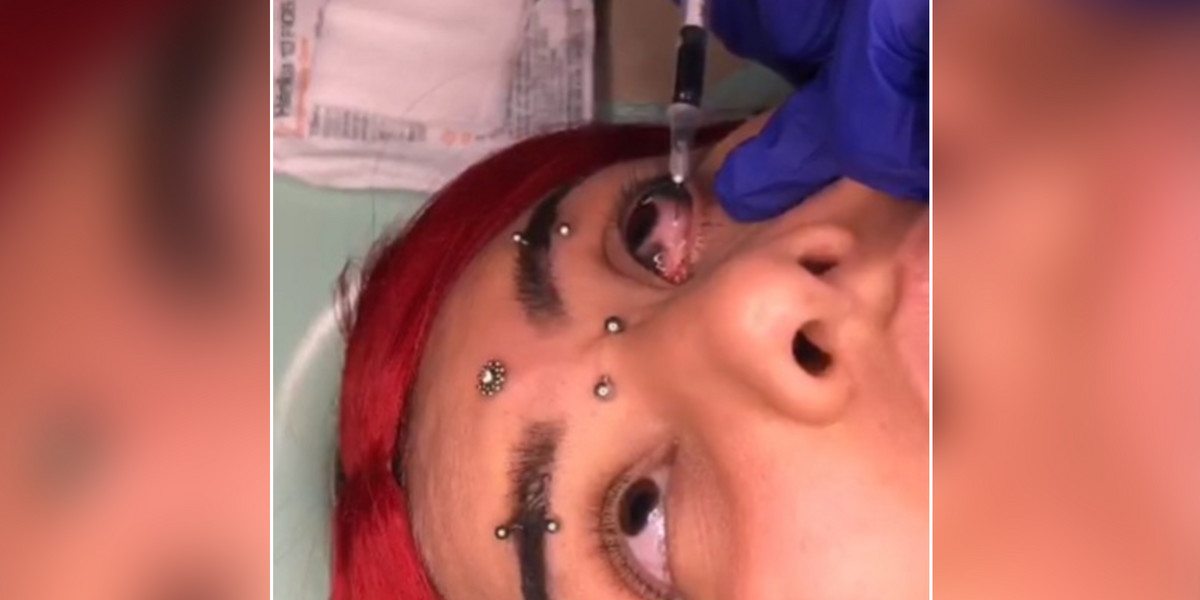 Tiktokerka pokazała, jak tatuują jej oczy. Internauci wyrazili swoją opinię.