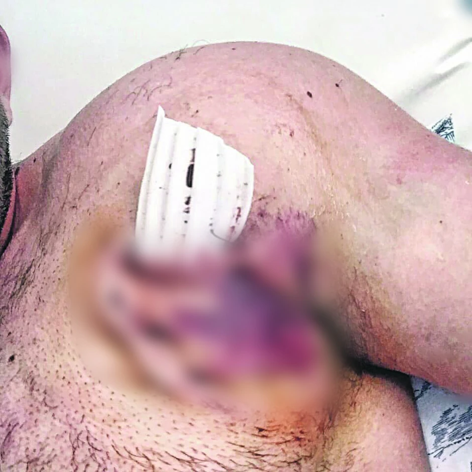 Stefan Tomić umalo je stradao od užasnih povreda koje je zadobio