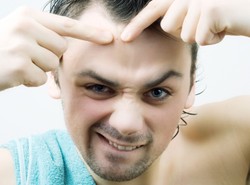 Rewolucyjny lek. Trądzik zniknie bez śladu