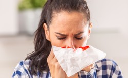 Pierwsza pomoc, gdy mamy krwawienie z nosa