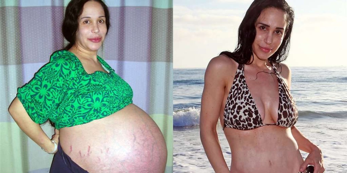 Nadya Suleman schudła 50kg