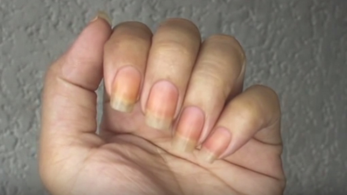 Podczas zmywania lakieru do paznokci zauważyłaś żółte plamy lub inne przebarwienia? Nie przejmuj się! Poznaj prosty trik, dzięki któremu błyskawicznie się ich pozbędziesz.