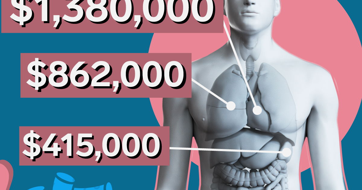 Why organ transplants are so expensive in the US [ARTICLE] Pulse Nigeria