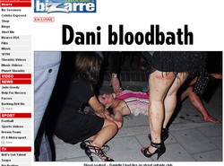 Kobiety pobiły dziewczynę piłkarza