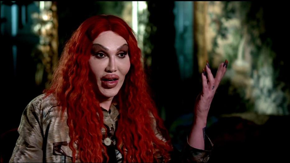 Pete Burns több mint 300 műtéten esett át /Fotó: Profimedia-reddot