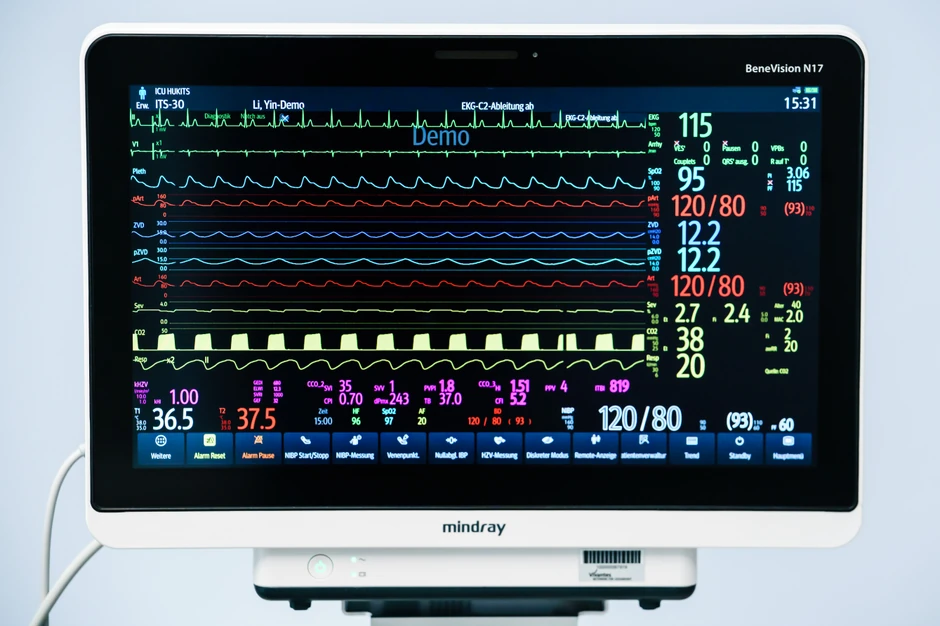 Stanje pacijenata prati se na monitoru povezanom sa respiratorom