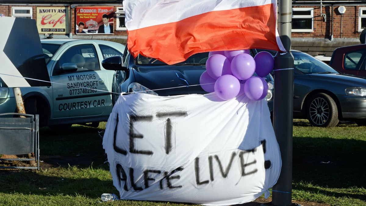 Alfie Evans reaguje na głos i dotyk ojca. Ma z rodzicami kontakt emocjonalny - zaznaczyła w rozmowie z PAP polska lekarka dr Izabela Pałgan, która w styczniu zbadała dwulatka na prośbę jego rodziców. Jej zdaniem, Alfie ma prawo do opieki paliatywnej.