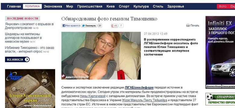 Tymoszenko pokazuje siniaki i zadrapania na swoim ciele