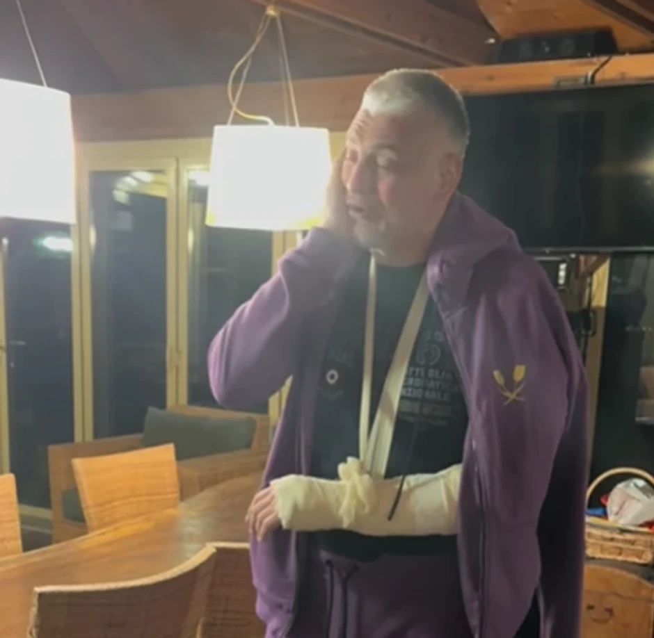 Čeda Jovanović sa rukom u gipsu