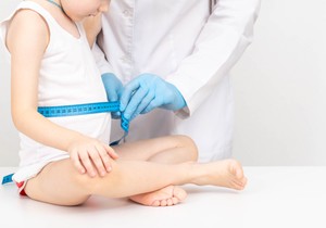 Kvašiorkor je najčešći kod dece, posebno u uzrastu od 3 do 5 godina