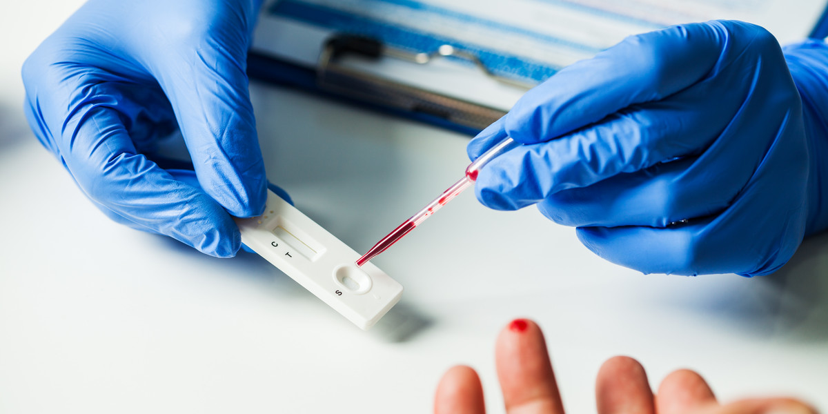 Testy na przeciwciała wirusa SARS-COV-2 znajdą się w ofercie sieci Lidl oraz Kaufland w Niemczech.