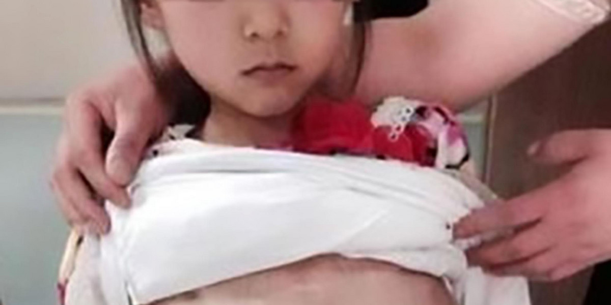 Chiny. 40-letni mężczyzna próbował oszukać lekarzy, że jego 12-letnia żona w ciąży jest pełnoletnia