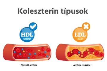 Koleszterin típusok