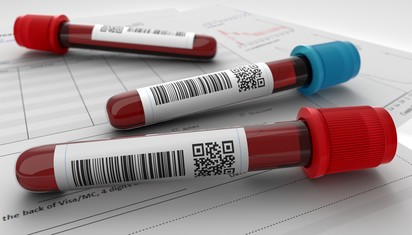 Évekkel a tünetek előtt kimutatható az emlőrák a vérből