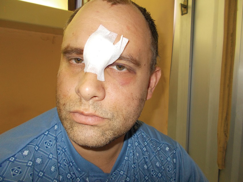 Pretučen naočigled sugrađana: Mladen Medić u bolnici