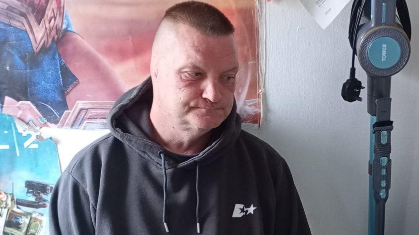 A dramatic dog attack on a 52-year-old in England. The beast bit his ear