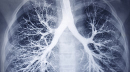 Naukowcy zbadali płuca zmarłych na COVID-19