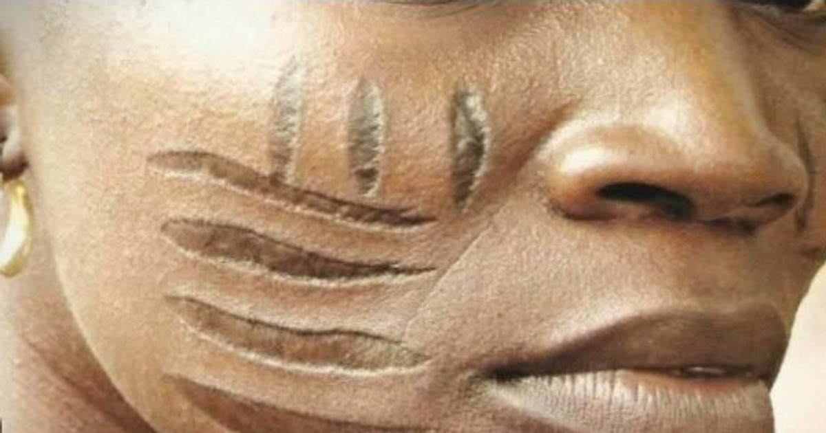 Why tribal marks were a thing and how to get rid of them Pulse Ghana