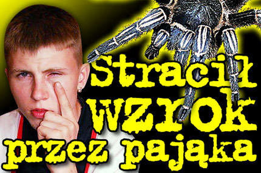 Stracił wzrok przez pająka