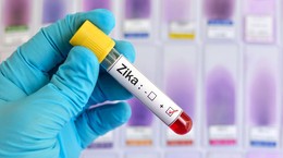 Epidemia Zika. Wirusem zakażone prawie 4 mln osób