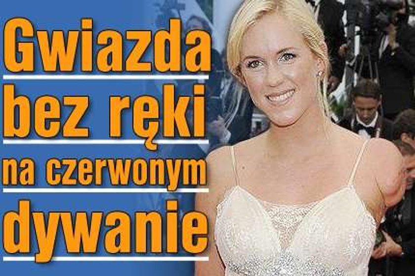 Gwiazda bez ręki na czerwonym dywanie