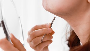Višak androgena vodi do ozbiljnih metaboličkih, reproduktivnih i psihičkih problema kod žena