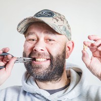 Hihetetlen: saját magának húzta, ki a fogát egy férfi, mert nem kapott időpontot a fogászatra
