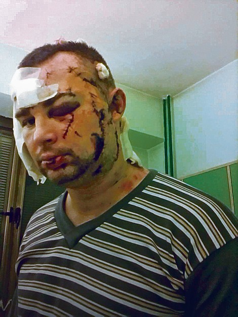 Vladimir Nedeljković je jedan od policajaca koji je brutalno pretučen