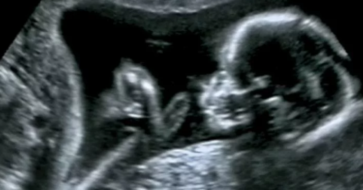 Wondering how to use a pregnancy test strip? Pulse Nigeria