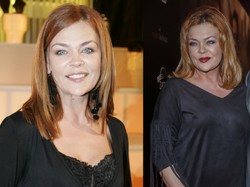 Trudno uwierzyć, że to ta sama osoba! Co jest z twarzą Beaty Kawki?