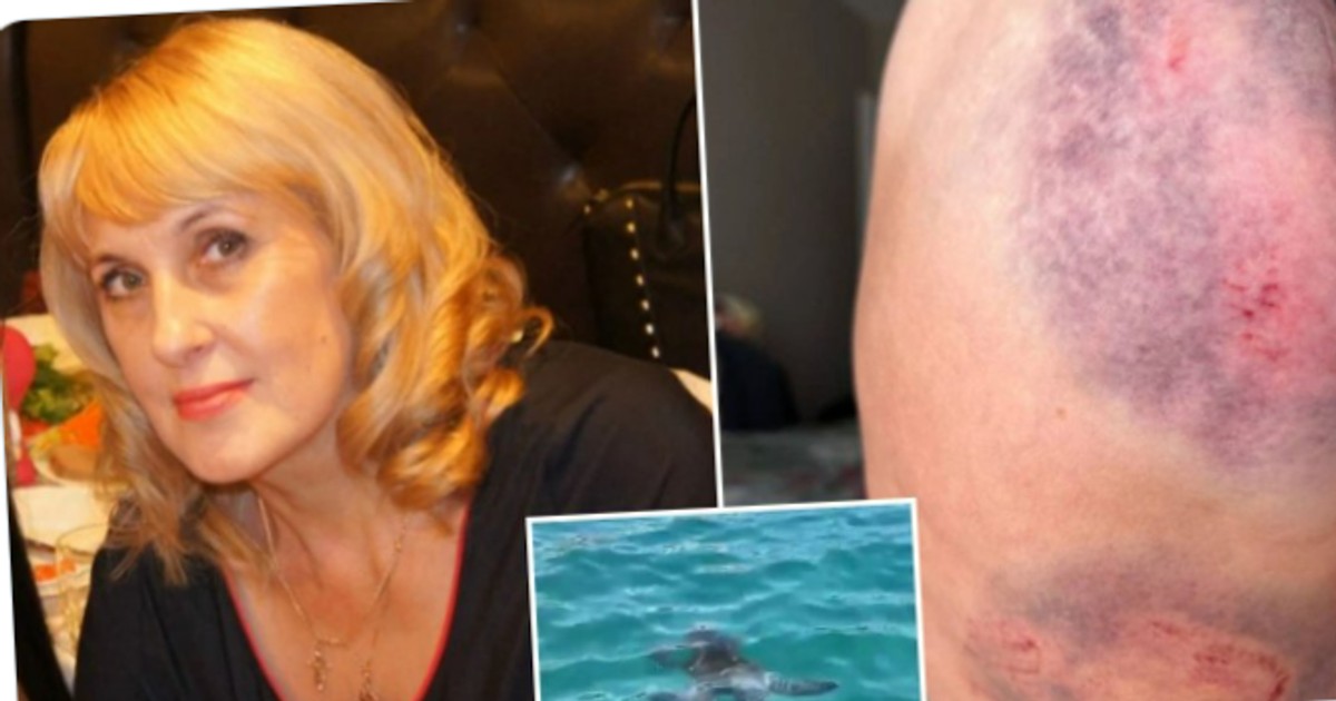 Żółw morski pogryzł rosyjską turystkę w Turcji