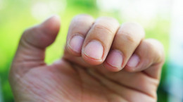 Diagnoza z paznokci. O jakich chorobach możemy się dowiedzieć?