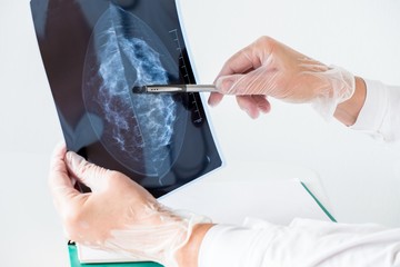 mellrák tünete emlőrák jele ajánlott vizsgálat nőknek
