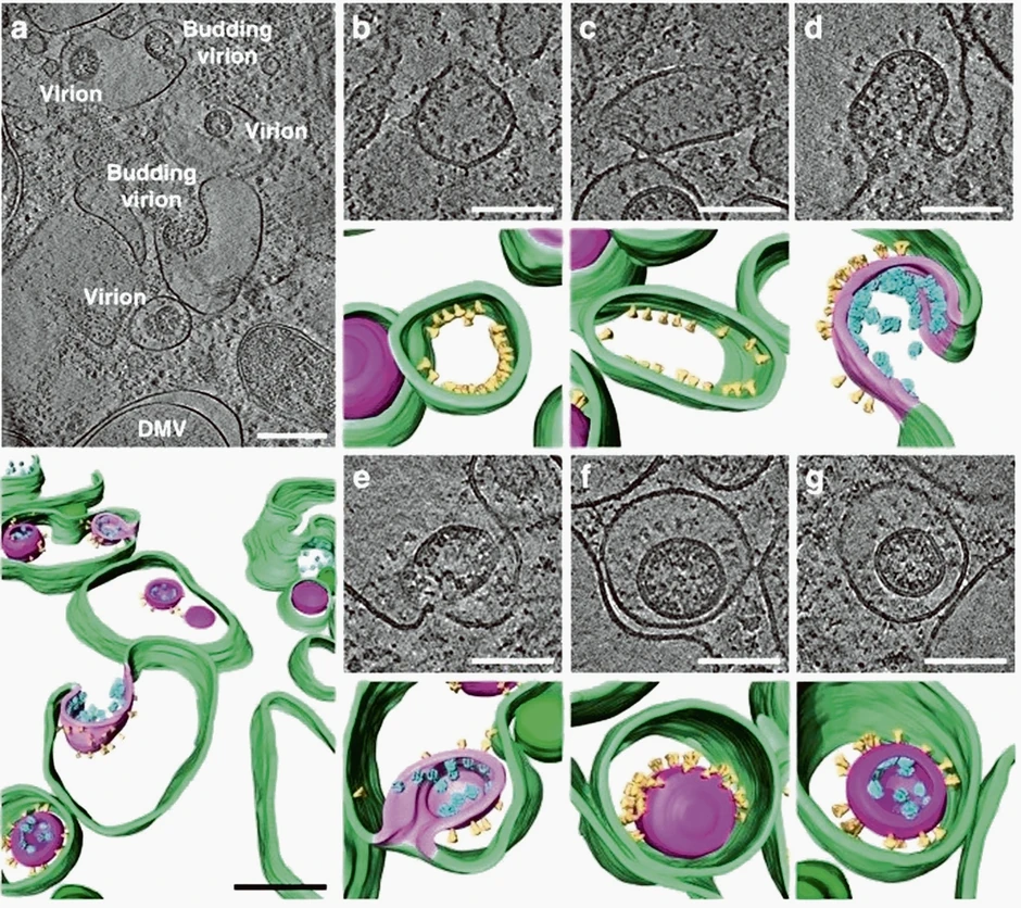 Virus: Zeleno su membrane unutar zaražene ćelije, ljubičasto virusna membrana, a žuto već čuveni šiljak protein virusa korona. A smutljivci kažu da ne postoji...