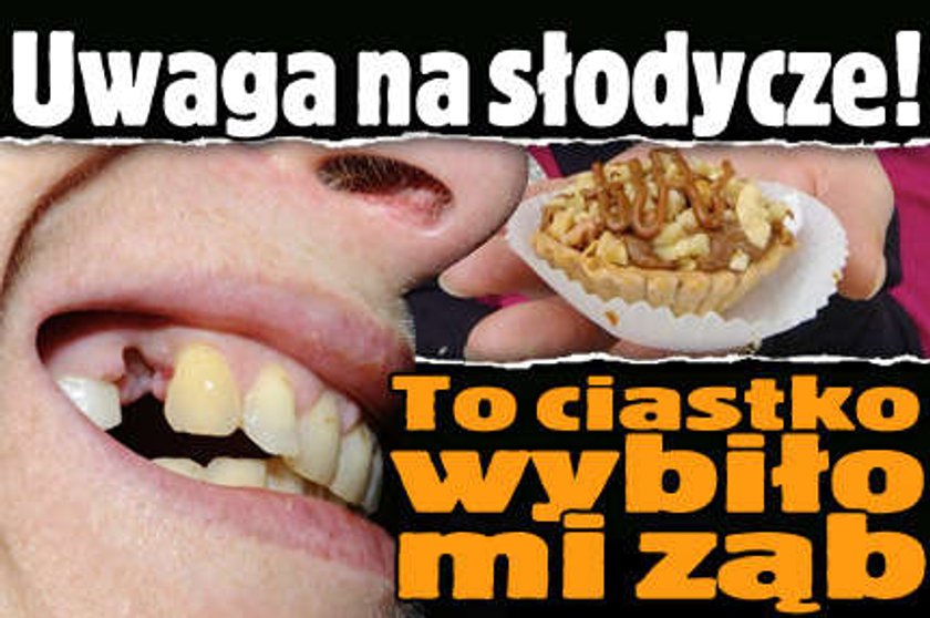 To ciastko wybiło mi ząb!