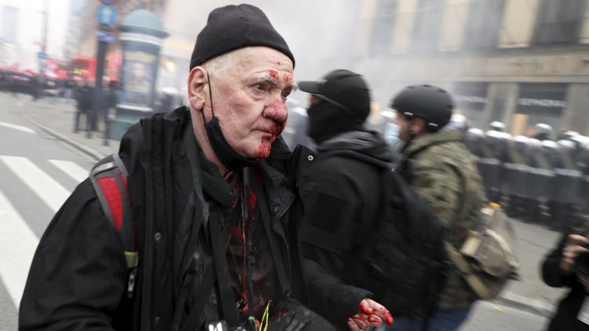 Policja zajmie się sprawą postrzelonego fotoreportera