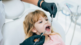 Jak rozpoznać początki próchnicy? Dentystka: zęby mleczne można leczyć