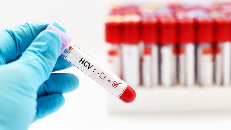 Próbka krwi na badanie HCV