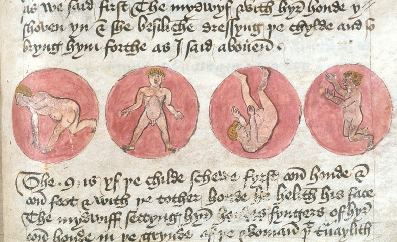 Położenia płodu w łonie Ta konkretna ilustracja pochodzi z ok 1460 roku