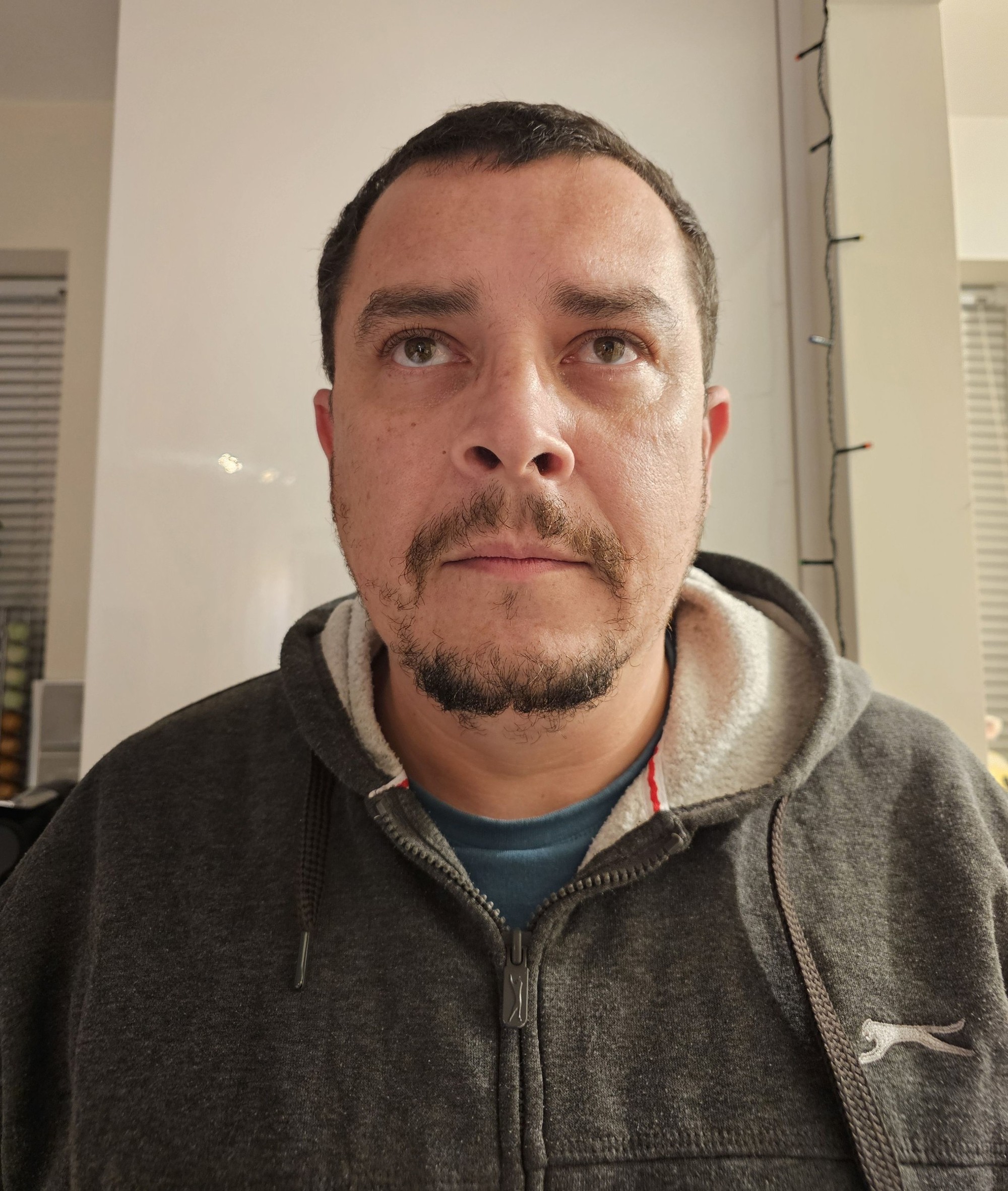 Edd teraz bojuje o život.