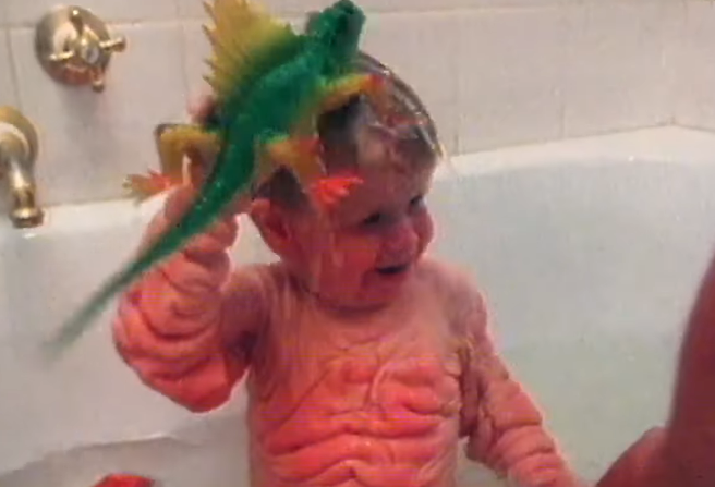 Jeho výzor prekvapil lekárov aj rodičov.