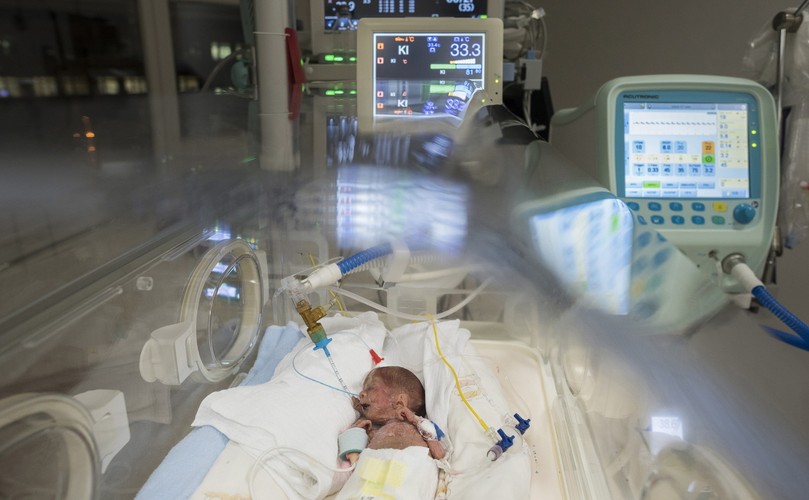 DZIEŃ WCZEŚNIAKA. Mali wojownicy w szpitalu Jósa András w mieście Nyíregyháza na Węgrzech